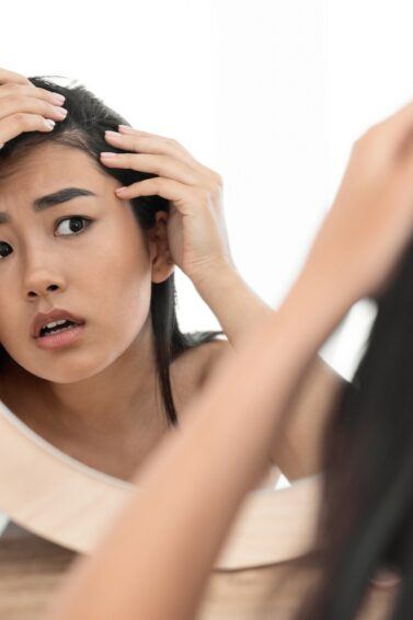 Seorang wanita Asia sedang bercermin sambil memegang rambutnya yang tipis.