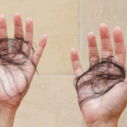 wanita sedang mengalami kerontokan rambut