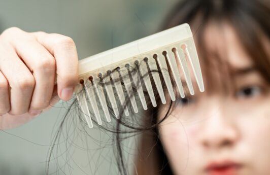 wanita asia sedang melihat rambutnya yang rapuh tersangkut di sisir