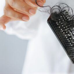 Mujer sosteniendo un cepillo lleno de caída del cabello
