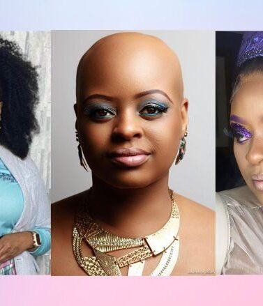 Denise's Natural Hair Loss Journey: Dealing with Alopecia with the Help of  Her Daughter - Coils To Locs