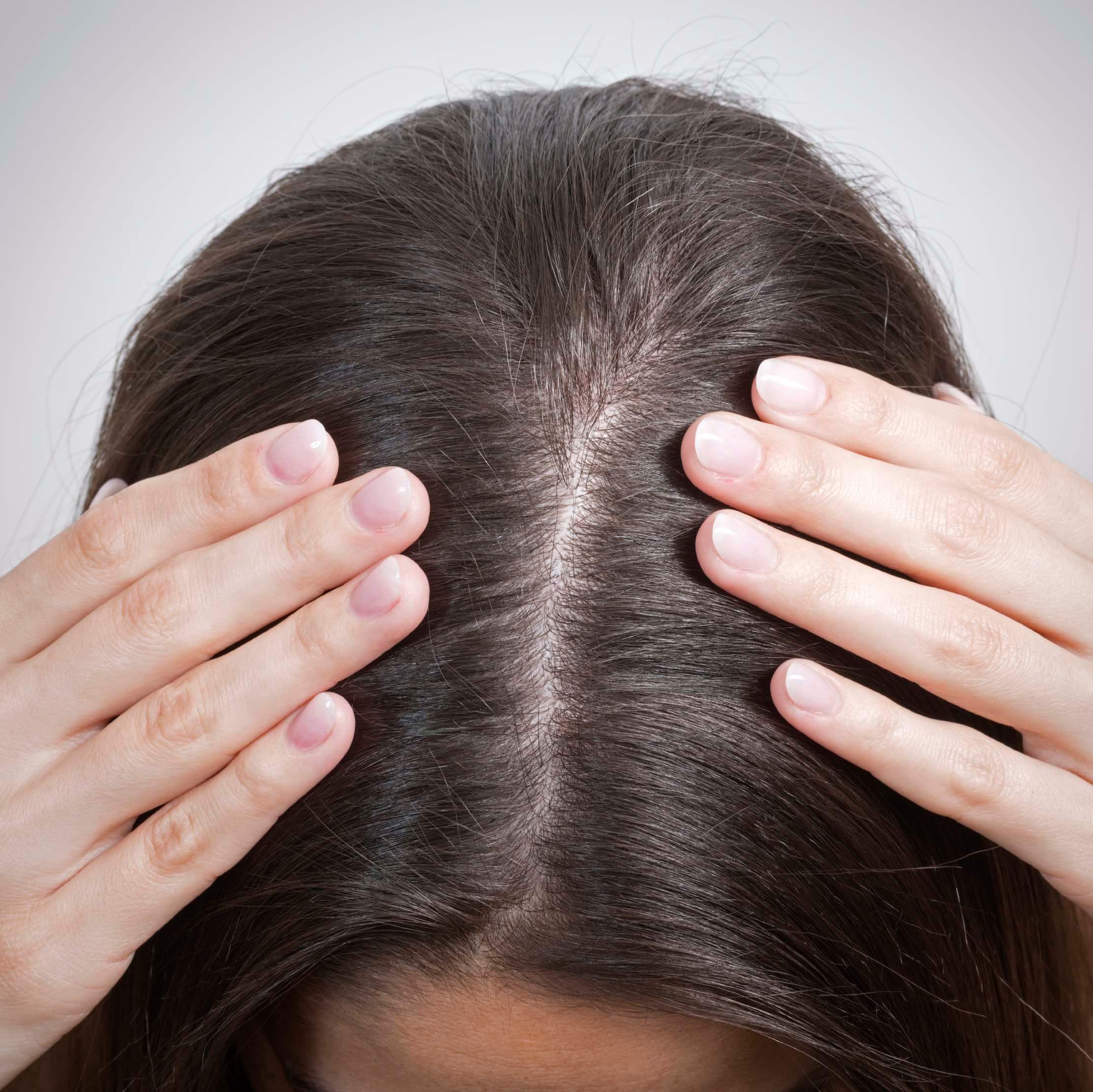Check your scalp health before your keratin treatment at home