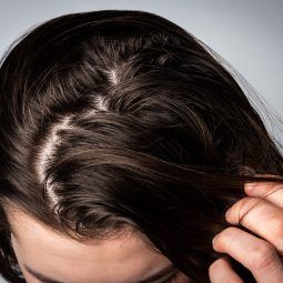 Woman with greasy, oily scalp touching her hair