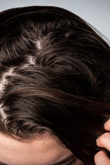 Woman with greasy, oily scalp touching her hair