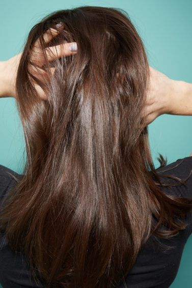 Thinning hair: Close up of scalp brunette woman thinning hair