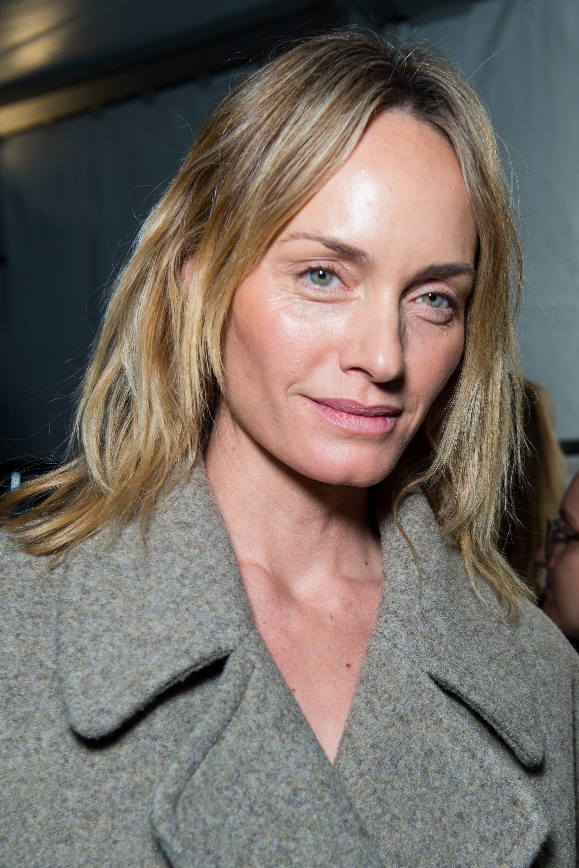 Woman with blonde thinning hair