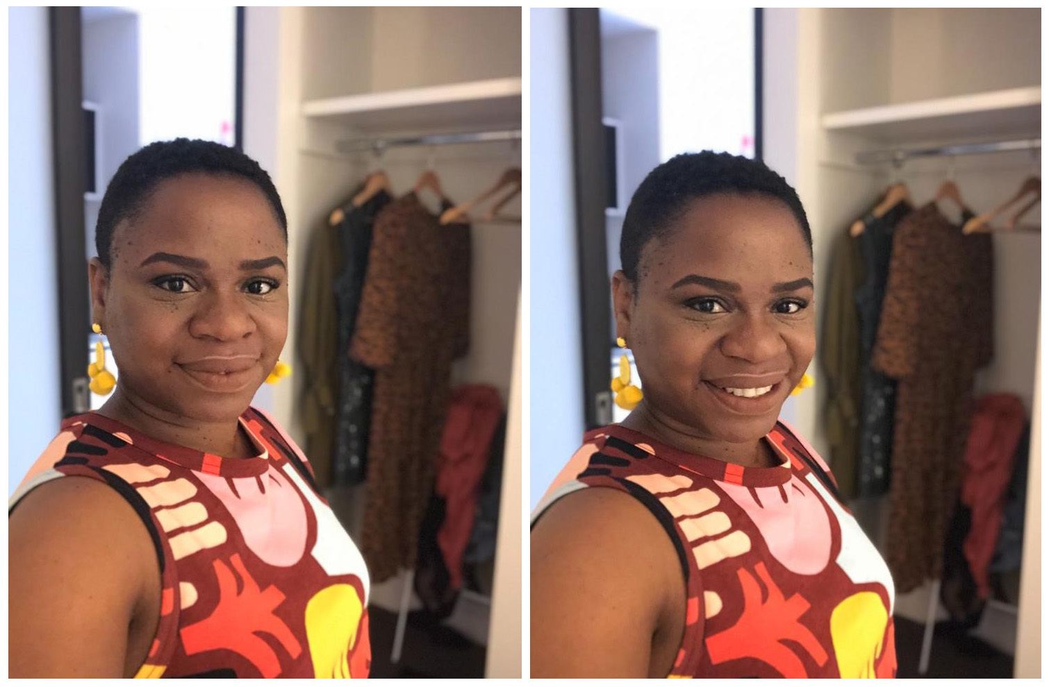 Real Hair Stories Nadia Williams: Young black woman with shaved hairstyle wearing a patterned dress
