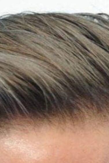David Beckham hairstyles for receding hair
