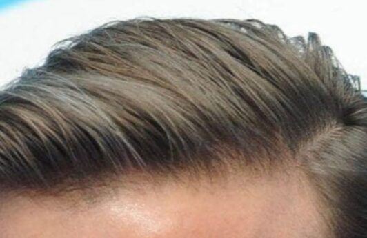 David Beckham hairstyles for receding hair