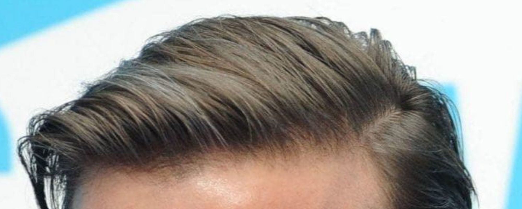 hairstyles for receding hair