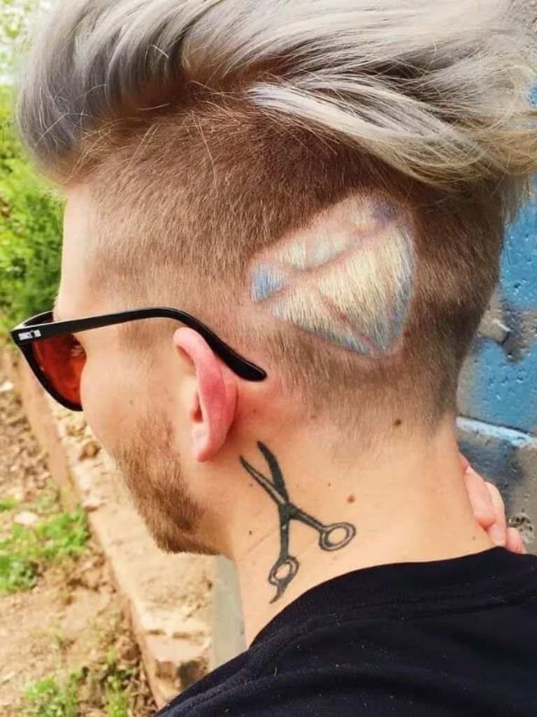 Patterned undercut